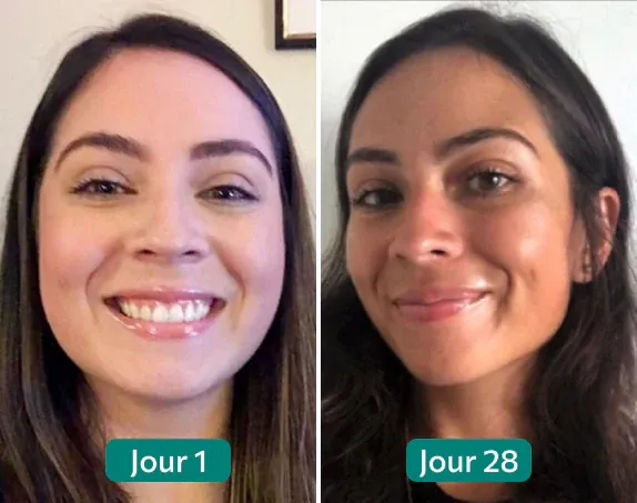 Résultat Cortisol Manager, visage moins gonflé après 28 jours